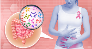 Microbiota y Cáncer de Mama: La Conexión Oculta