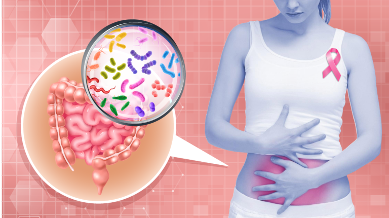 Microbiota y Cáncer de Mama: La Conexión Oculta