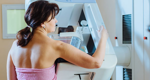 Acceso a los Servicios de Mamografía