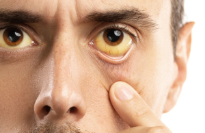 LAS HEPATITIS VIRALES, UNA INFECCIÓN SILENCIOSA LAS HEPATITIS VIRALES UNA INFECCION SILENCIOSA