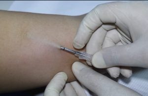 Panamá Norte promueve la salud femenina con la colocación de implantes subdérmicos