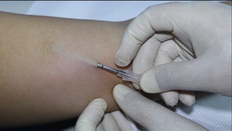 Panamá Norte promueve la salud femenina con la colocación de implantes subdérmicos