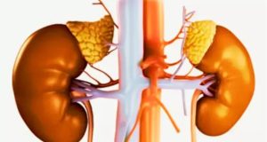 La Nefropatía Diabética