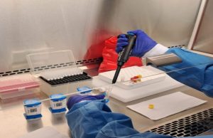 Panamá acelera respuesta, tratamiento y diagnóstico de la tuberculosis (TB)