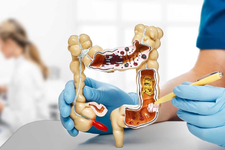 Impulsando la detección temprana del cáncer colorrectal: estudio panameño evalúa la prueba inmunoquímica fecal (FIT) como herramienta clave.